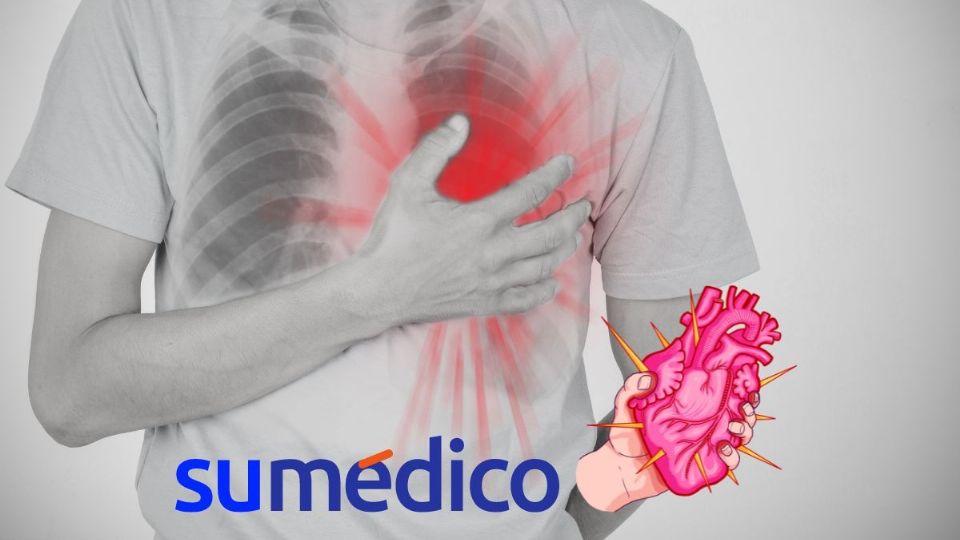 Así puedes diferenciar de una angina de pecho a un infarto.