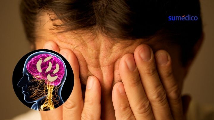 Hombre tenía migrañas y descubrió que la causa era un gusano en su cerebro