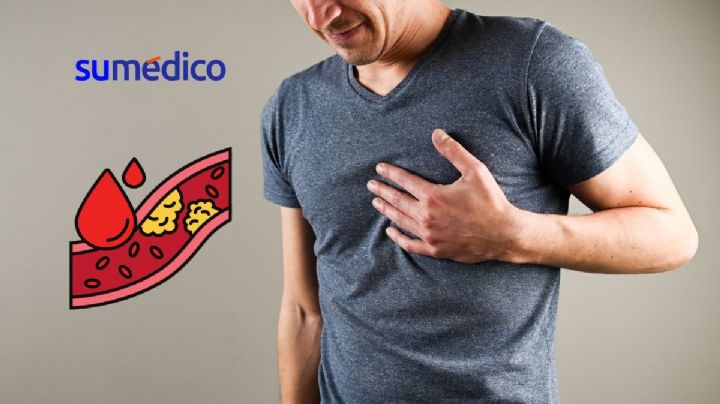 ¿Qué síntomas corporales pueden avisar sobre colesterol alto?