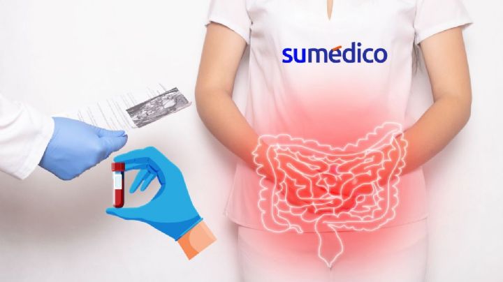 ¿Se puede detectar cáncer de colon a través de una prueba de sangre?