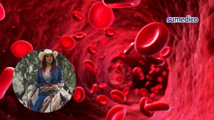 Trombosis, posible causa de muerte de la fundadora de Cuacolandia ¿Qué es?