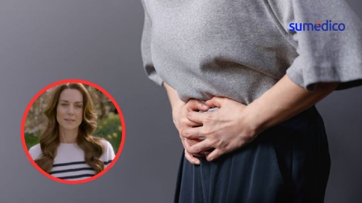 Médico explica qué tipo de cáncer podría tener Kate Middleton