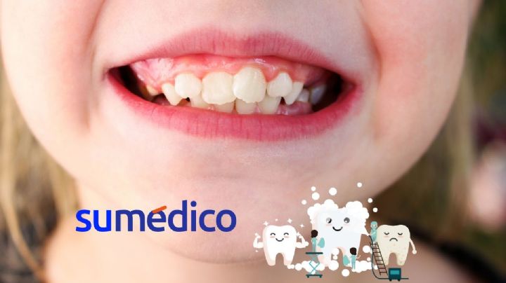 ¿Qué hacer si un niño tiene los dientes chuecos?