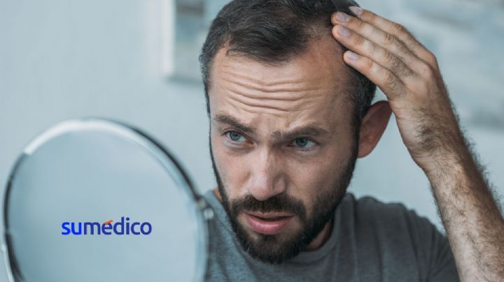 5 consejos para evitar la caída del cabello