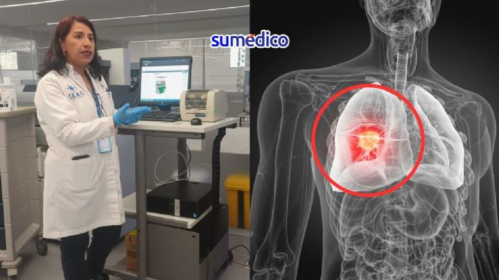 Con medicina de precisión redefinen el tratamiento contra cáncer de pulmón