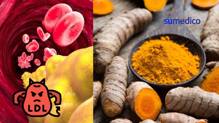 ¿Cómo tomar la cúrcuma para bajar el colesterol?