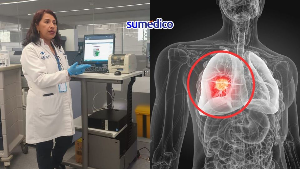 La medicina de precisión da esperanza a los pacientes con cáncer de pulmón.