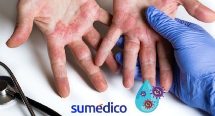 Recomendaciones de una dermatóloga para cuidar tu piel del agua contaminada en CDMX