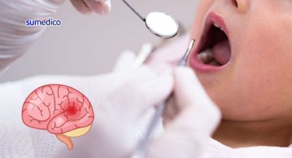 Médicos extraen una aguja de dentista del cerebro de una niña de 4 años