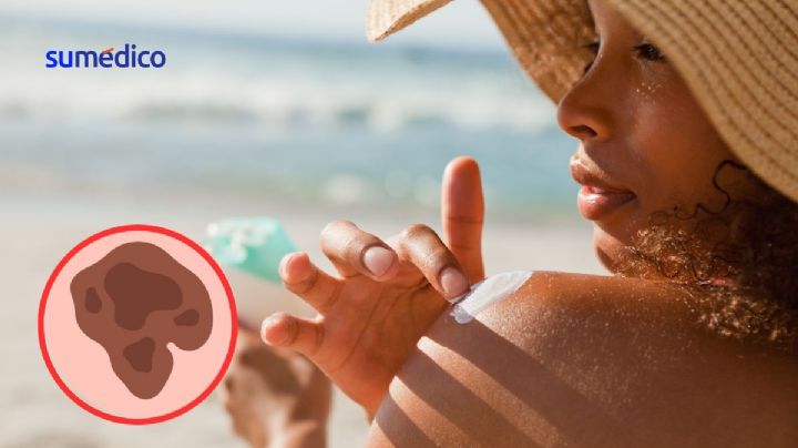 Protégete contra el calor, aquí te decimos cómo cuidar tu piel esta temporada