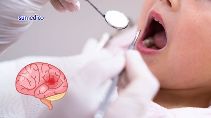 Médicos extraen una aguja de dentista del cerebro de una niña de 4 años