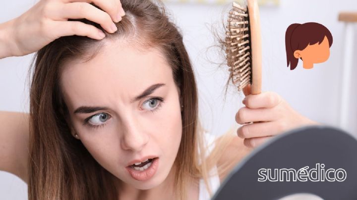 ¿Por qué amarrarse el cabello en exceso puede provocar alopecia por tracción?