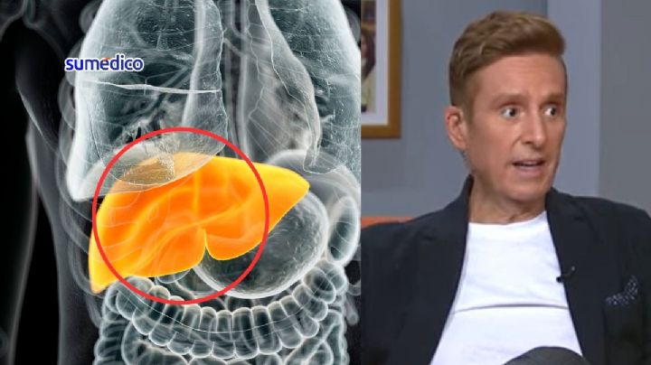 ¿Qué síntomas da el hígado graso, padecimiento que causó complicaciones en la salud de Daniel Bisogno?