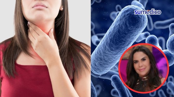 ¿Qué es la infección por estreptococo que afectó a Paola Rojas?