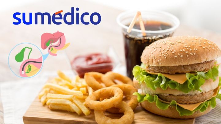 ¿Qué no se puede comer con la vesícula inflamada?