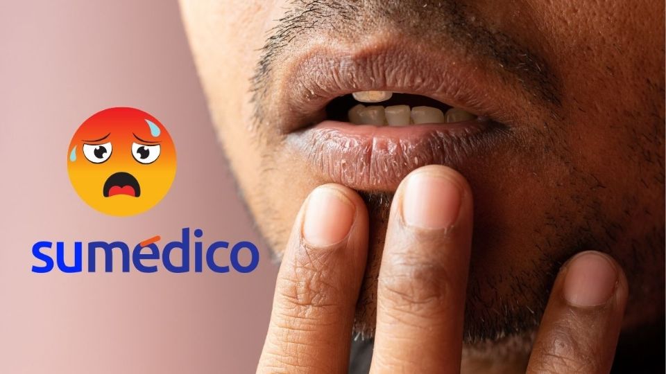 Así afecta las altas temperaturas a los labios.