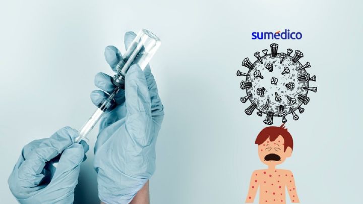 ¿Qué vacuna es la que te protege del sarampión y cuántas dosis son?