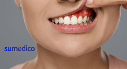 ¿Qué son los mitos odontológicos? 5 mitos sobre tus encías