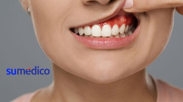 ¿Qué son los mitos odontológicos? 5 mitos sobre tus encías