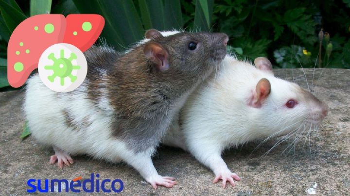 ¿Qué es la hepatitis de las ratas? Enfermedad que está causando alerta en España