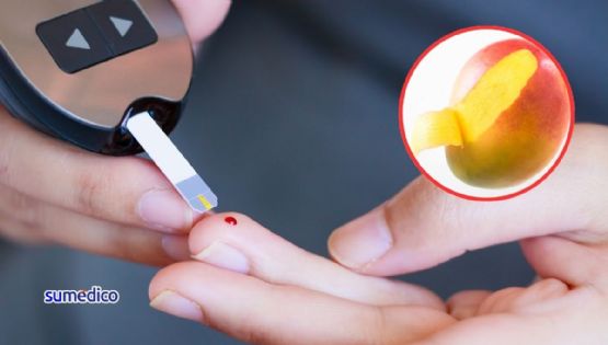 ¿Tienes diabetes? Esto pasa con tu glucosa cuando comes mango