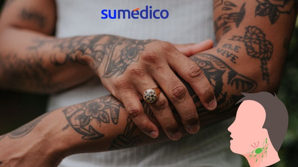 Los tatuajes pueden causar linfoma