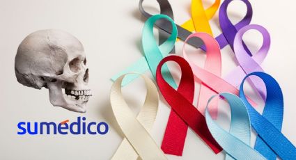 Así descubren primera operación de cáncer con ayuda de un cráneo