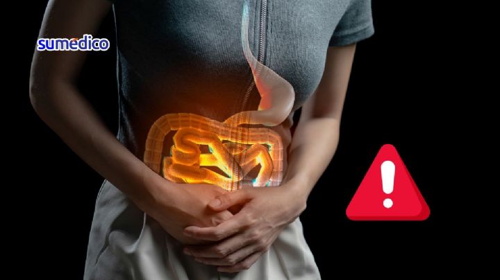 ¿Qué causa infecciones intestinales en época de calor? Experta dice cómo prevenir