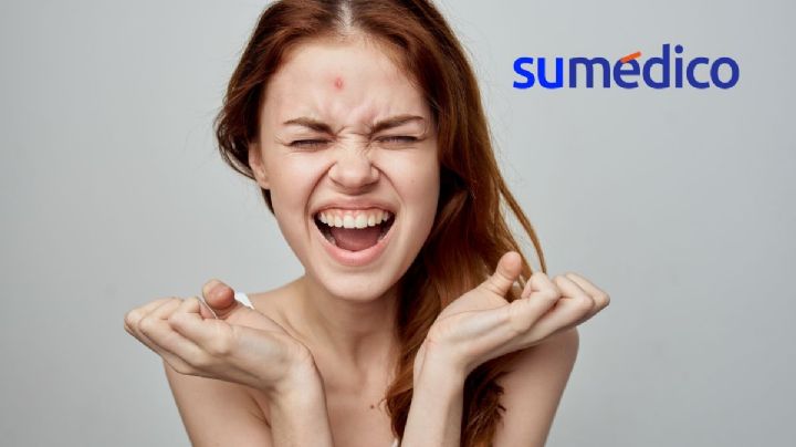¿Qué hacer para bajar la inflamación de un grano? 5 trucos que no conocías