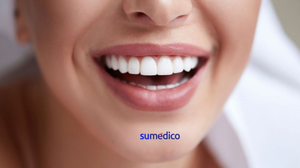 Descubre los consejos para mantener unos dientes sanos