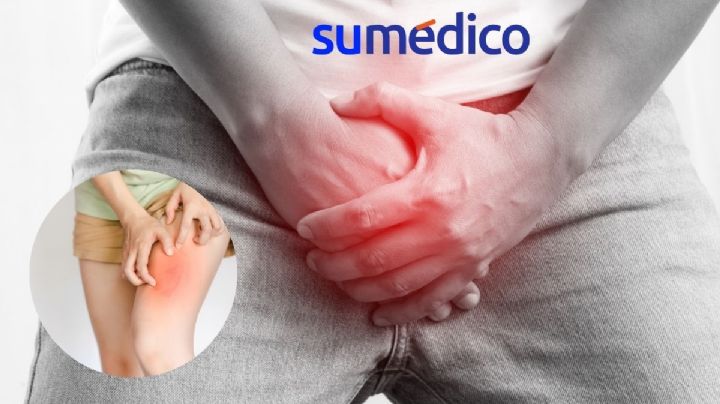 ¿Cuál es la nueva enfermedad sexual que cada vez es más común en Europa?