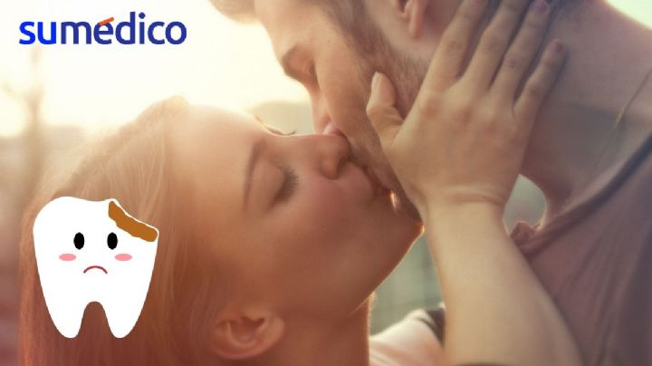 ¿Se pueden contagiar las caries al besar a una persona?