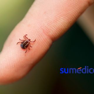 Alertan por la fiebre del conejo: estos son los síntomas