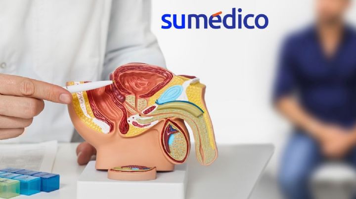 ¿Cómo se manifiesta el cáncer de próstata?