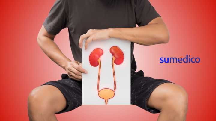 Signos de cáncer de vejiga en hombres que no debes ignorar