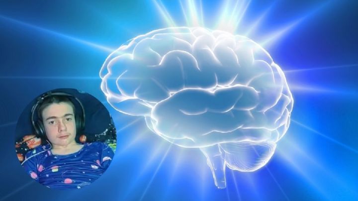 El dispositivo cerebral que cambió la vida de un niño con epilepsia