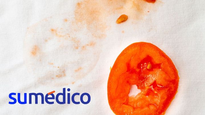 ¿Cómo quitar una mancha de jitomate? 5 trucos que debes conocer