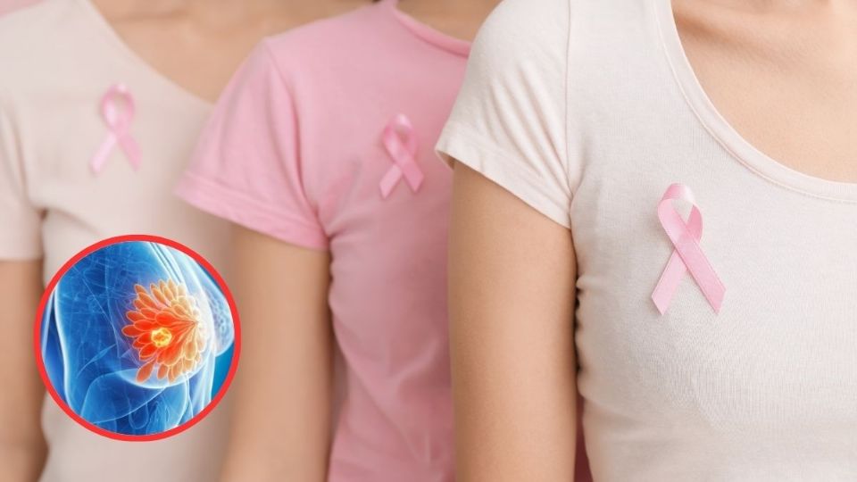 Se abordó, entre otros temas, la presencia de cáncer de mama asociado al embarazo.