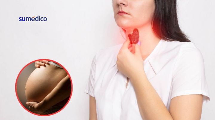 ¿Por qué el hipotiroidismo es más común en mujeres?