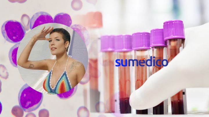 La cantante Halsey revela su diagnóstico de lupus y leucemia ¿Qué son?