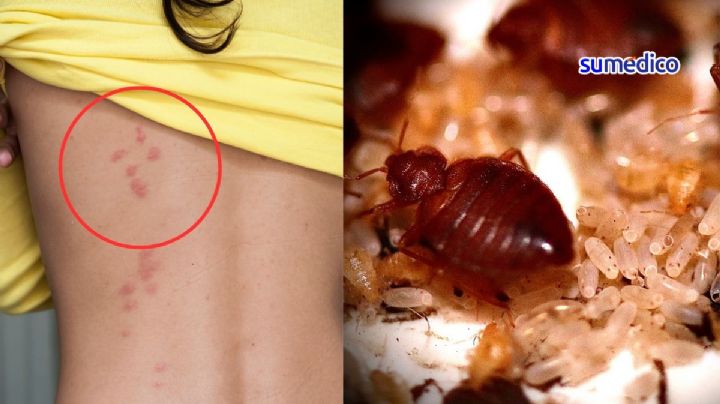 El remedio definitivo contra las chinches de cama sin usar químicos