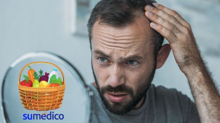 5 alimentos que debes consumir para evitar la caída del cabello