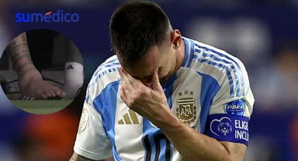 ¿Qué tan grave es una lesión como la de Lionel Messi y cómo será su rehabilitación?