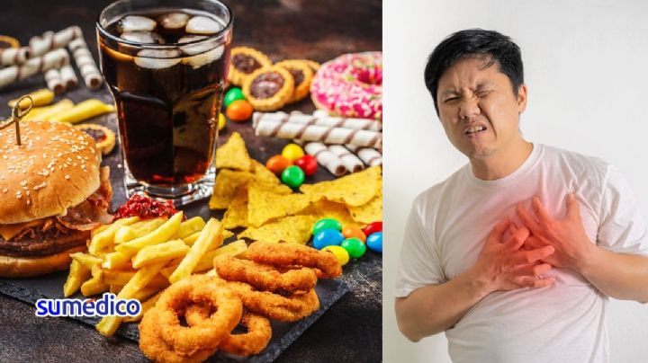 10 enfermedades que causan los alimentos ultraprocesados