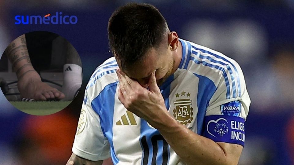 Se dio a conocer la magnitud de la lesión de Messi