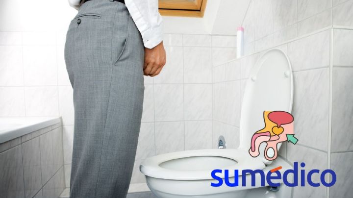 ¿Orinar parado o sentado? Esta es la recomendación de un urólogo