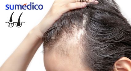 Así es el gel que estimula el crecimiento del cabello