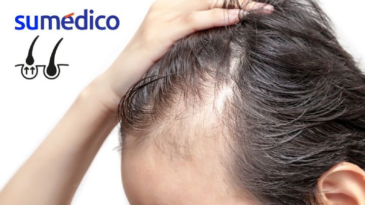 Así es el gel que estimula el crecimiento del cabello