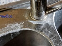 Cómo limpiar el fregadero para quitar manchas y dejarlo como nuevo