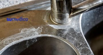 Cómo limpiar el fregadero para quitar manchas y dejarlo como nuevo